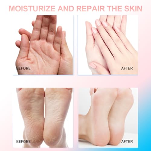 Eourhsa Crack Feet Prevention Stick, Eourhsa Foot Balm, Eoursha Crack Heel Cream -Smooth Protective BalM, Foot Balm for Dry Cracked Feet, Refreshing, Hydrating, Deep Moisturizing (Pink+Blue, one size)