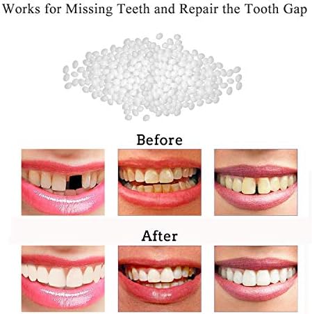 Tooth Repair Kit-Thermal Beads for Filling Fix The Missing and Broken Tooth or Adhesive The Denture Fake Teeth