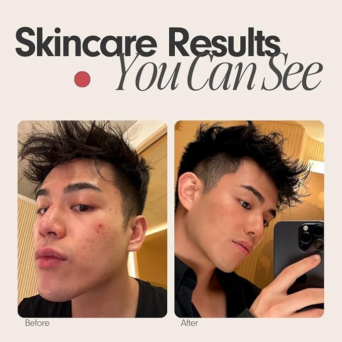 Sxnse Palm Silicone Face Scrubber – Compact Electric Facial Cleansing Brush for Acne, Pores & Makeup – Waterproof Face Exfoliator with 3 Speeds – Rechargeable Skincare Tool for Sensitive Skin (Jet)